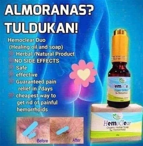 butas ng pwet|ALMURANAS O ALMORANAS: ANO GAMOT, .